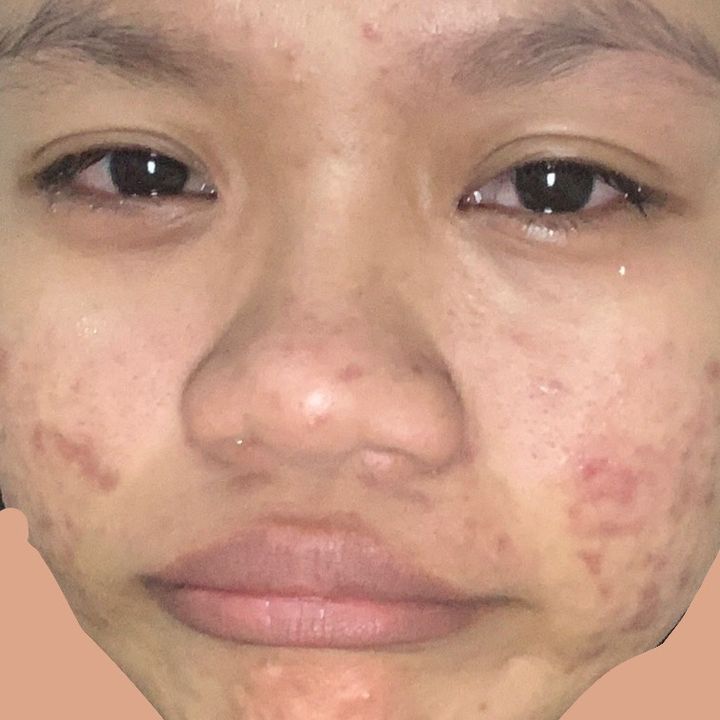 belumlulusjadiacnefight1