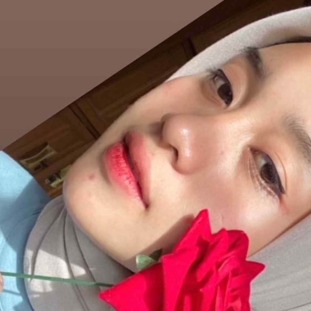 beranteminjerawat
